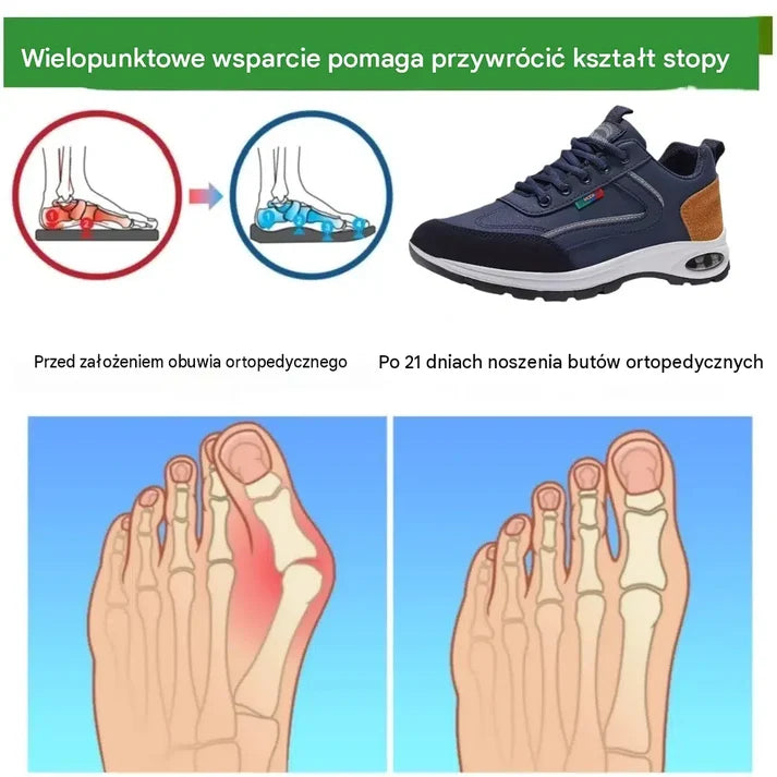 Ostatni dzień! 48% zniżki! Buty ortopedyczne zaprojektowane specjalnie dla osób z problemami stóp, zapewniające wsparcie łuku stopy i łagodzące ból pleców, stawów i stóp.