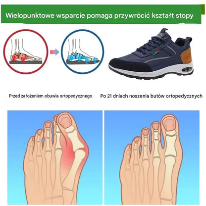 Ostatni dzień! 48% zniżki! Buty ortopedyczne zaprojektowane specjalnie dla osób z problemami stóp, zapewniające wsparcie łuku stopy i łagodzące ból pleców, stawów i stóp.