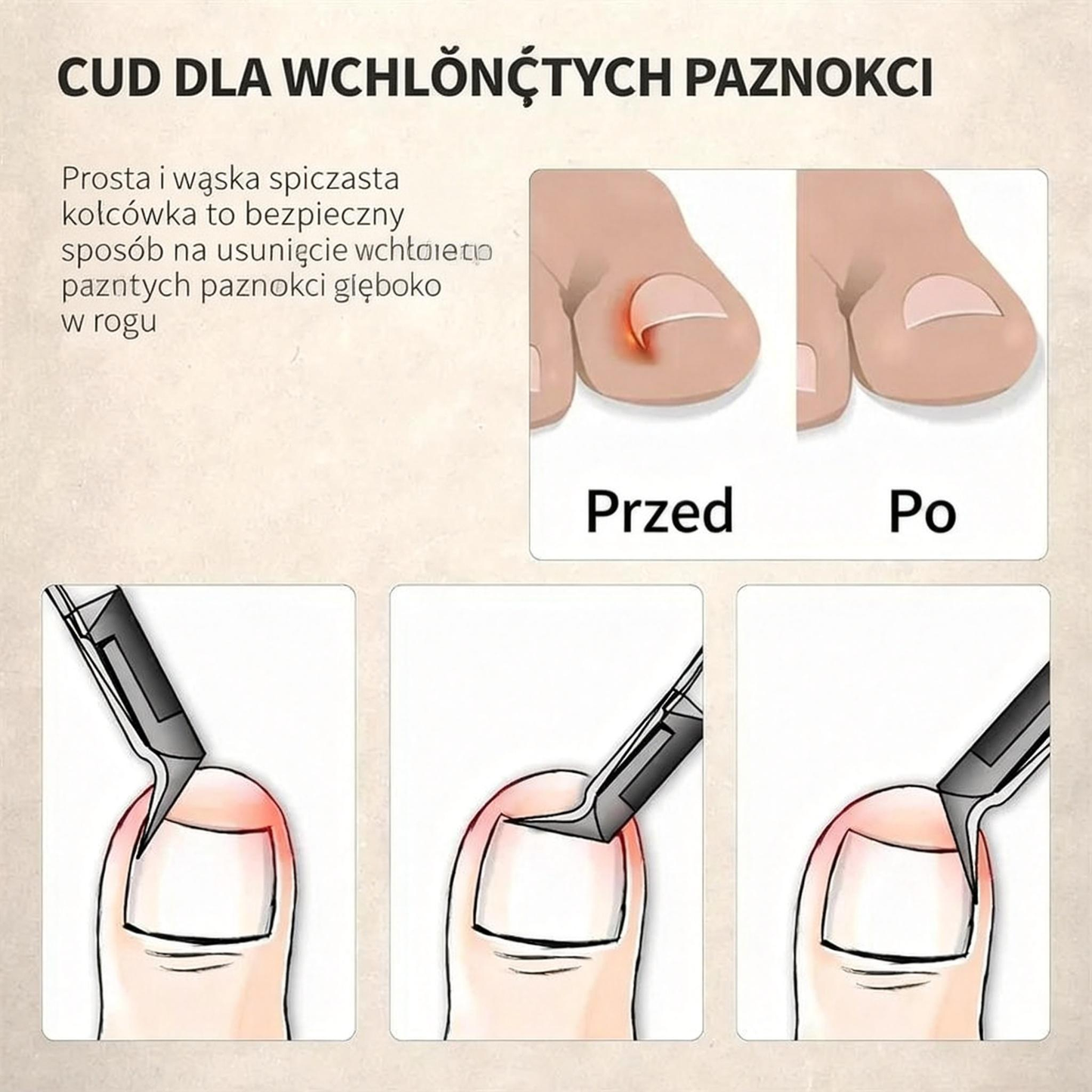 🎉 Ekskluzywne dla członków –Specjalnie zaprojektowane dla seniorów nożyczki do paznokci przeciw rozpryskiwaniu , z lupą 🔍 dla precyzyjnego i bezpiecznego przycinania