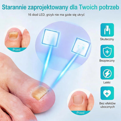 Potrójna Lampa do Pielęgnacji Paznokci – 7 Minut Dziennie dla Czystszego i Zdrowszego Wyglądu Paznokci