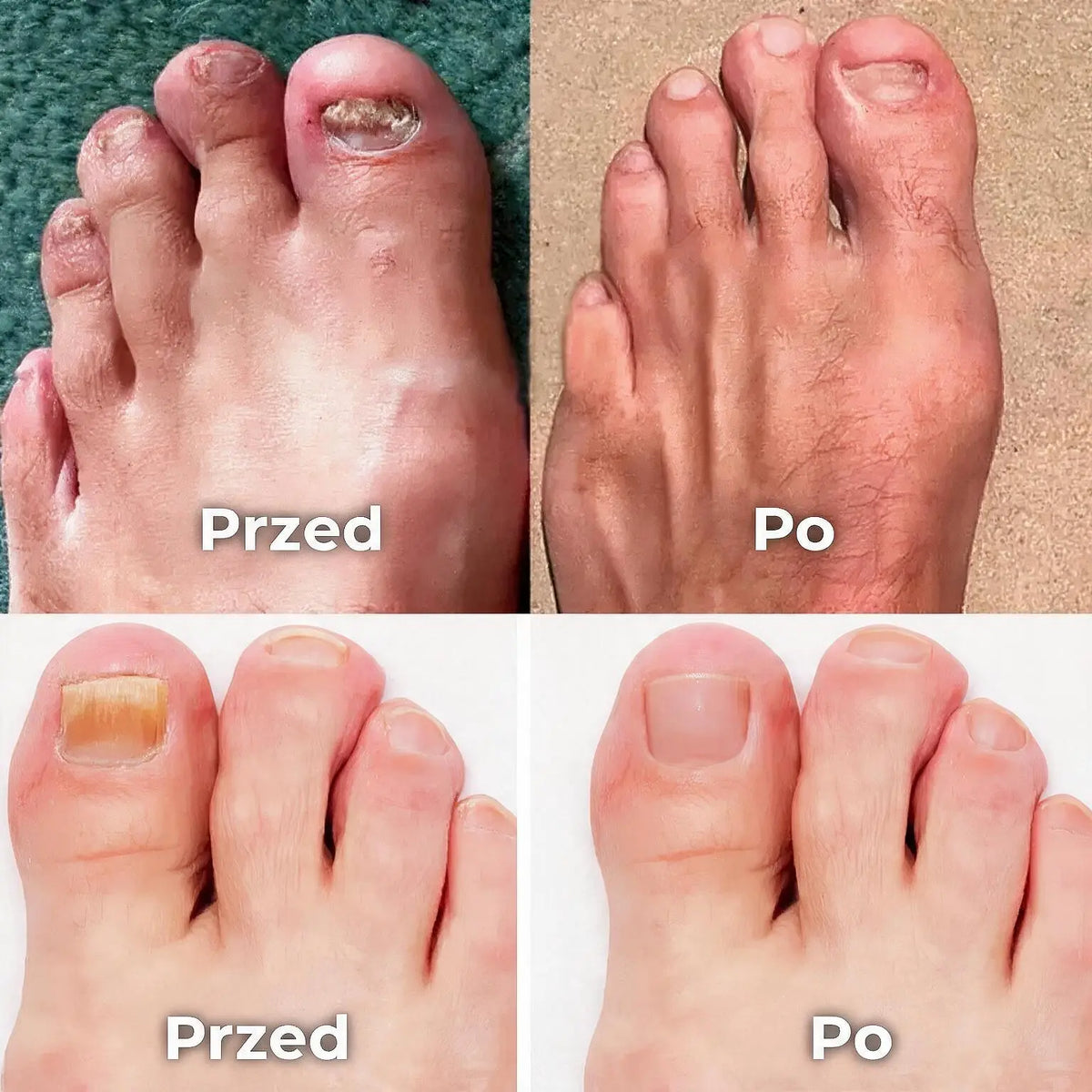 Potrójna Lampa do Pielęgnacji Paznokci – 7 Minut Dziennie dla Czystszego i Zdrowszego Wyglądu Paznokci