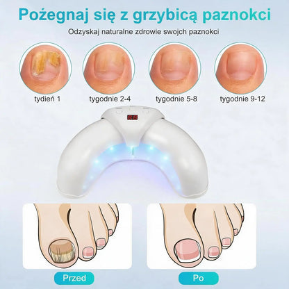Potrójna Lampa do Pielęgnacji Paznokci – 7 Minut Dziennie dla Czystszego i Zdrowszego Wyglądu Paznokci